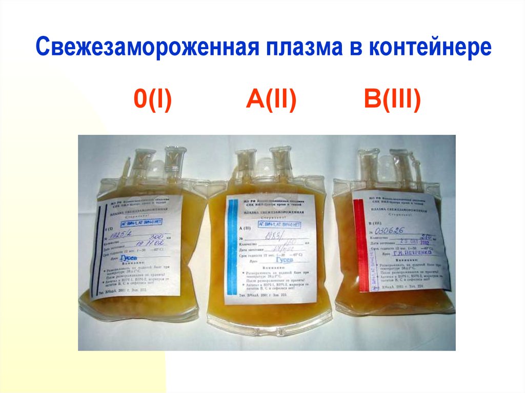 Трансфузия свежезамороженной плазмы. Свежезамороженная плазма (СЗП). Плазма нативная свежезамороженная сухая. СЗП плазма крови. Переливание свежезамороженной плазмы.