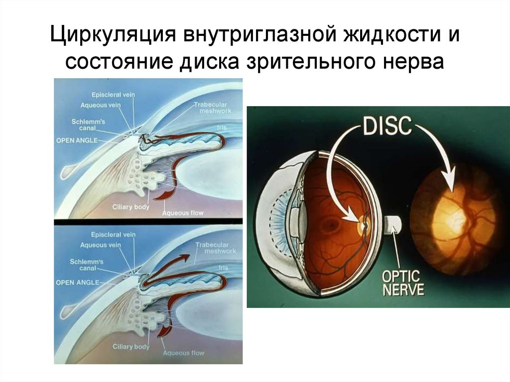 Схема оттока внутриглазной жидкости