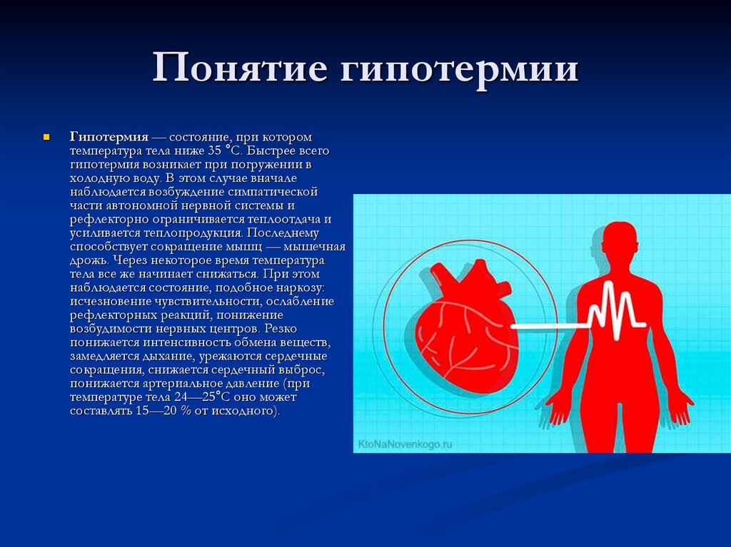 Гипотермия патофизиология презентация