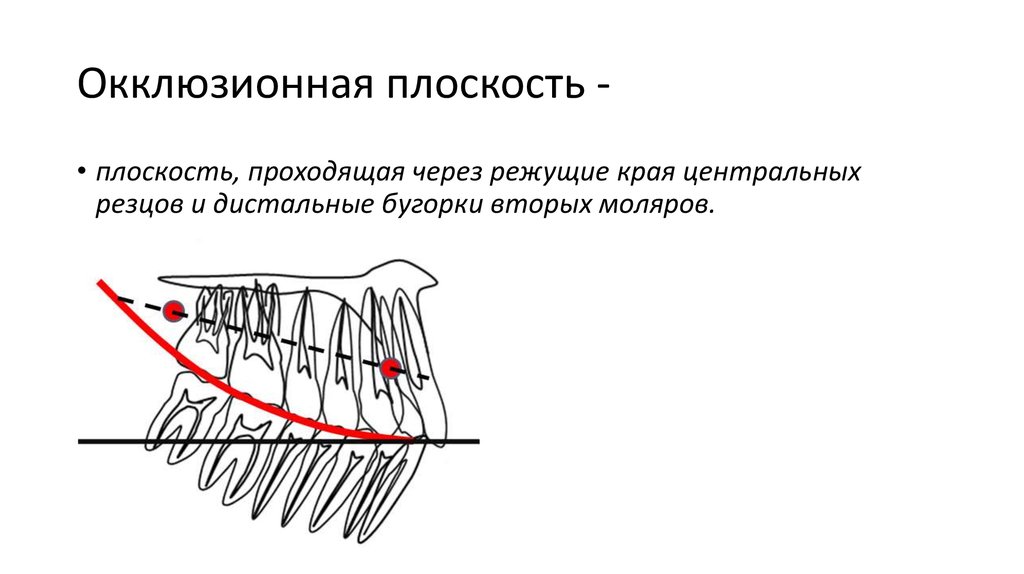 Окклюзионная схема кувата