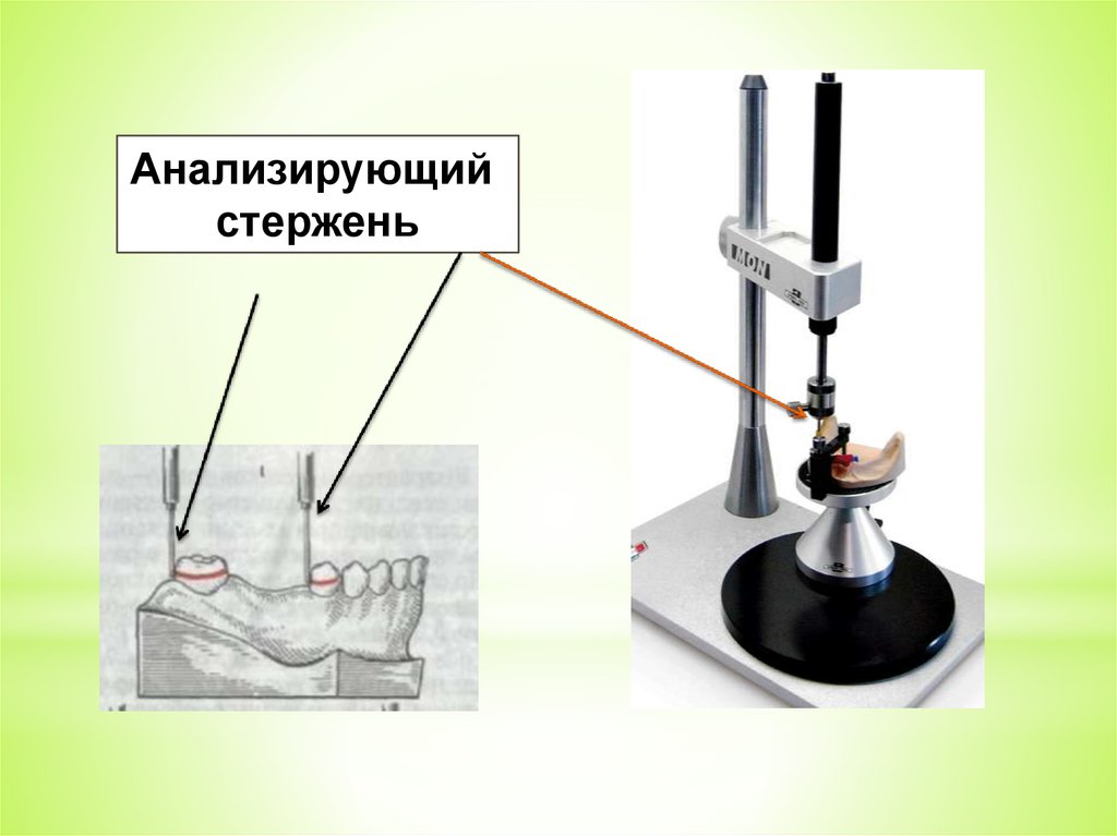 Презентация на тему параллелометрия