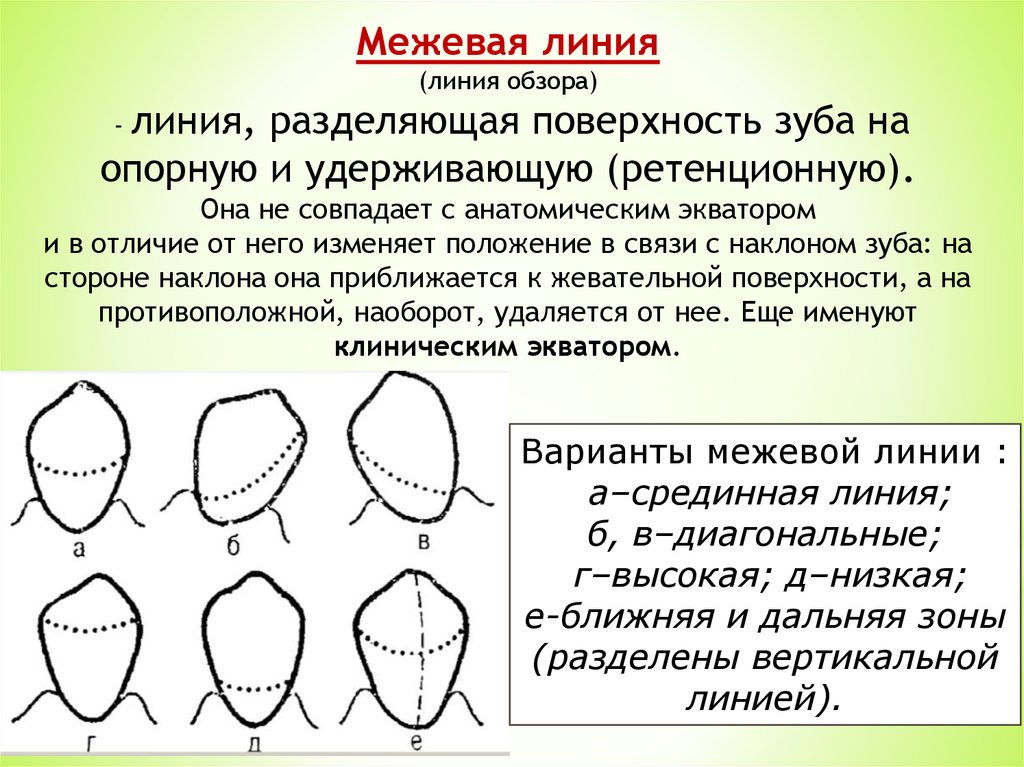 Линия определение. Линия обзора в ортопедической стоматологии это. Межевая линия зуба это. Расположение Межевой линии. Линия обзора стоматология.