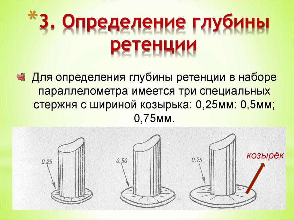 Измерение глубины. Определение глубины ретенции. Стержень для определения ретенции. .Определение глубины ретенции параллелометрии.
