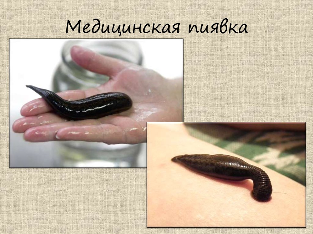 Медицинская пиявка