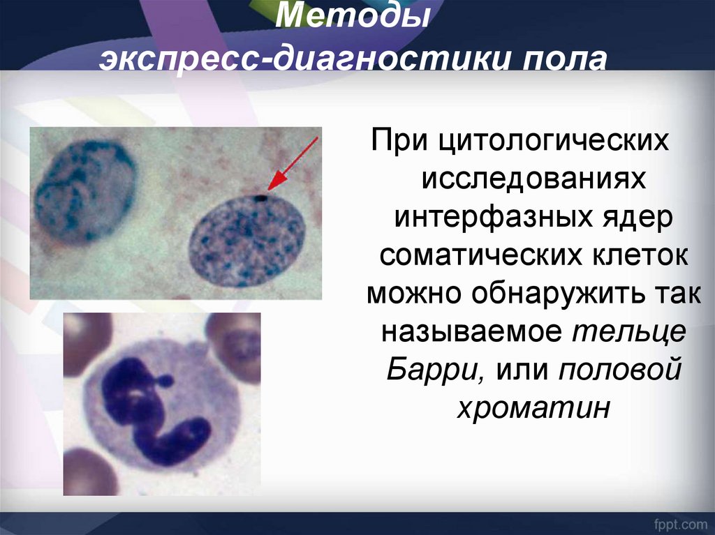 Тельца барра в клетках. Цитологический метод изучения наследственности человека. Экспресс-диагностики пола. Метод экспресс диагностики пола. Метод диагностики с половыми диагнозом.