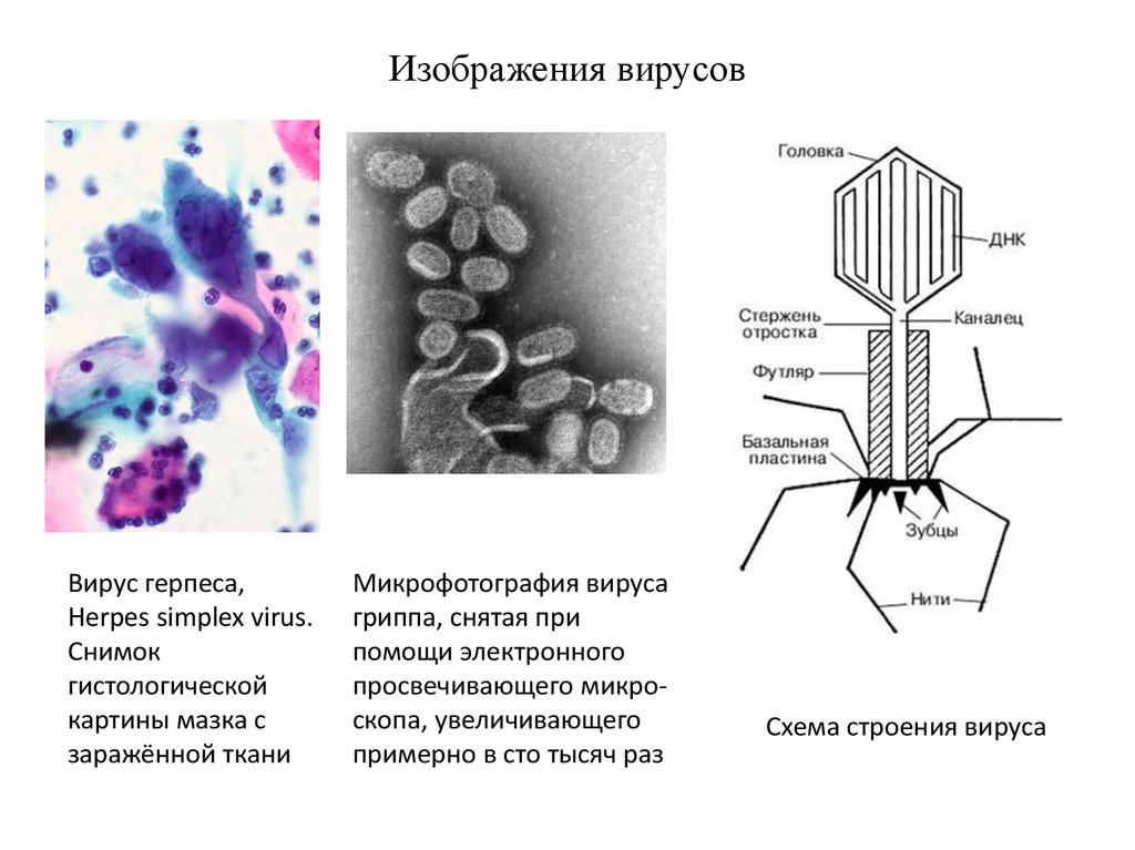 Рисунок вирус герпеса