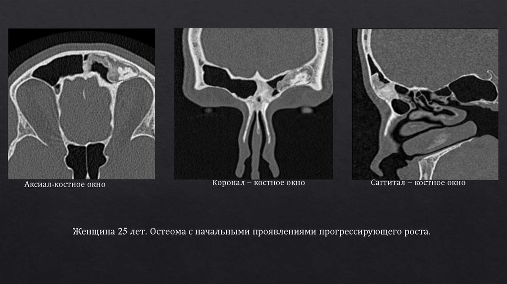 Лучевая диагностика костей презентация