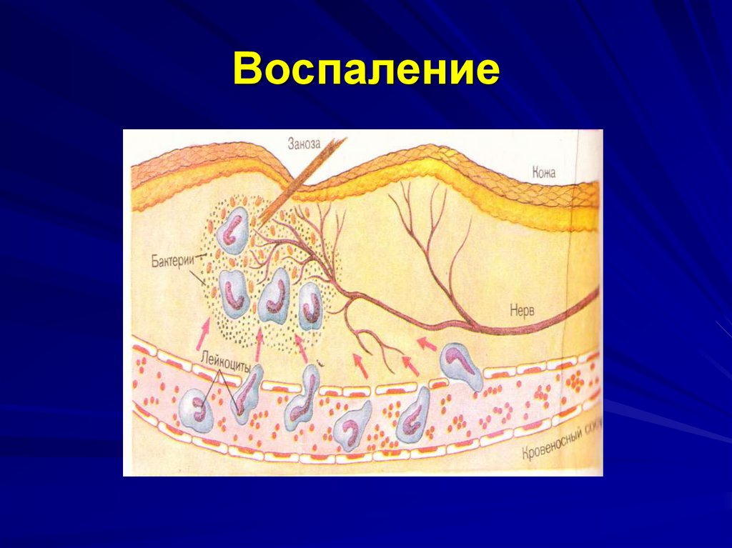 Воспаление картинки для презентации