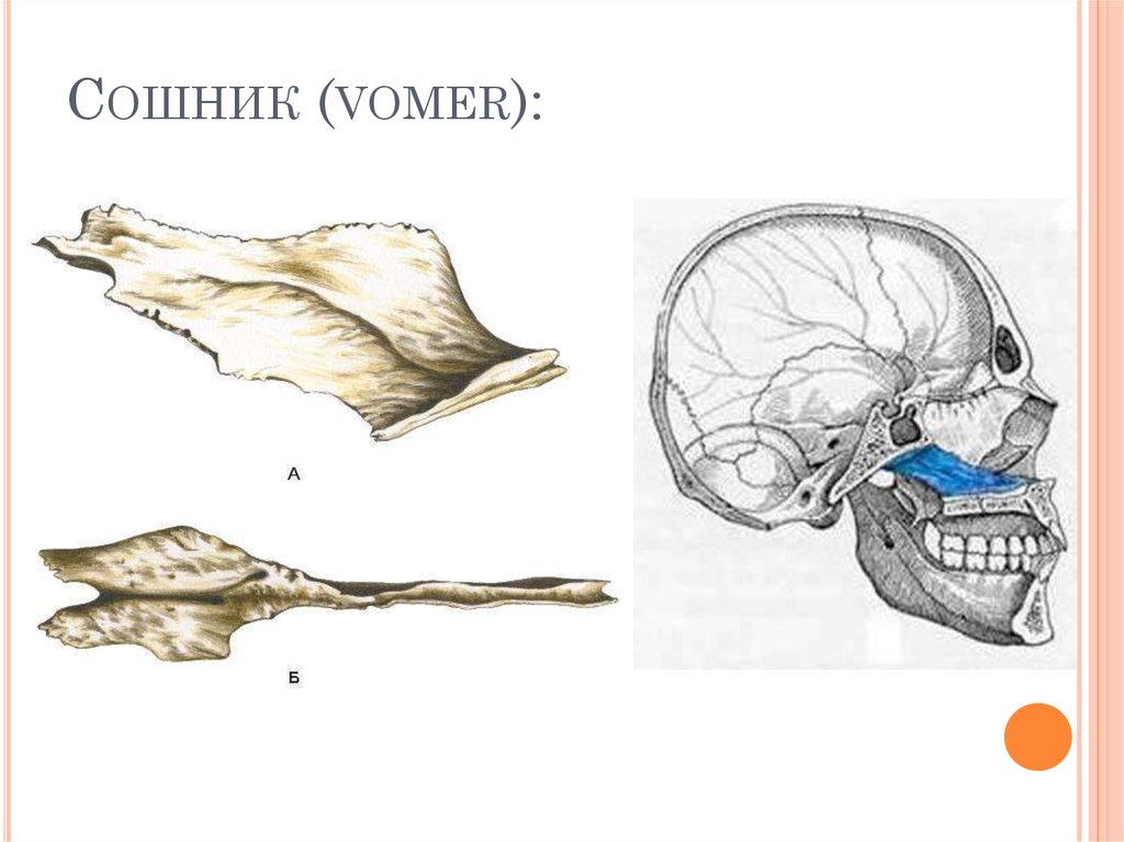 Сошник кость. Сошник кость черепа анатомия. Строение черепа сошник. Сошник кость анатомия человека. Сошник кость анатомия строение.