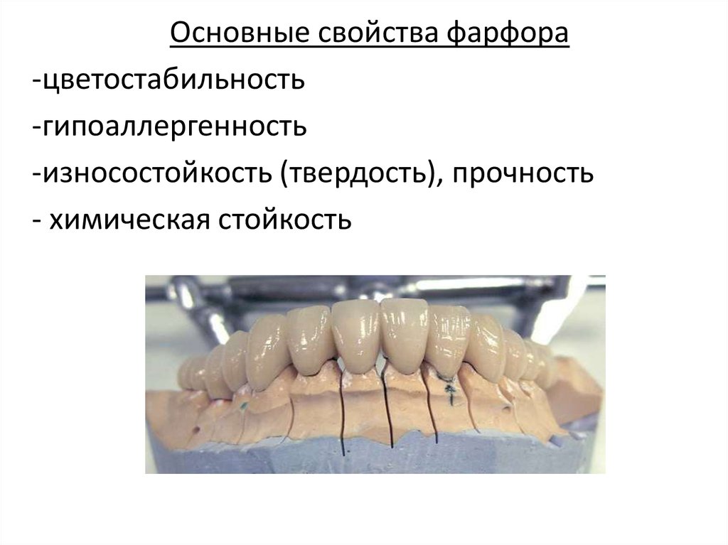 Презентация керамика в стоматологии