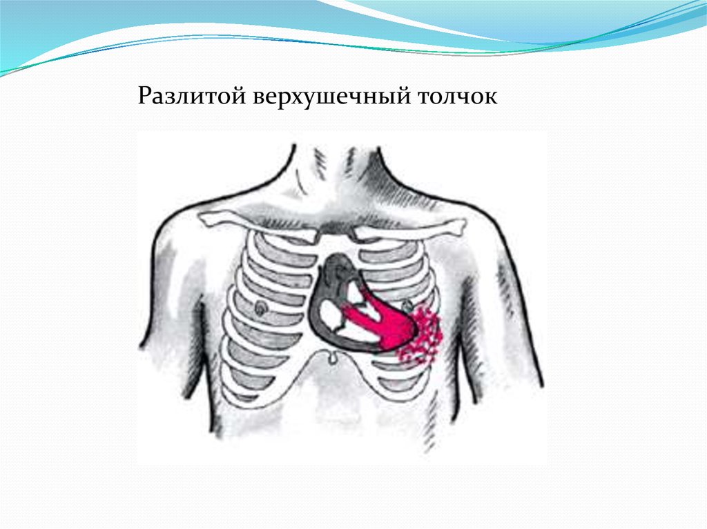 Сердечный толчок у животных. Митральная недостаточность верхушечный толчок. Недостаточность митрального клапана верхушечный толчок. Разлитой верхушечный толчок. Верхушечный толчок сердца.