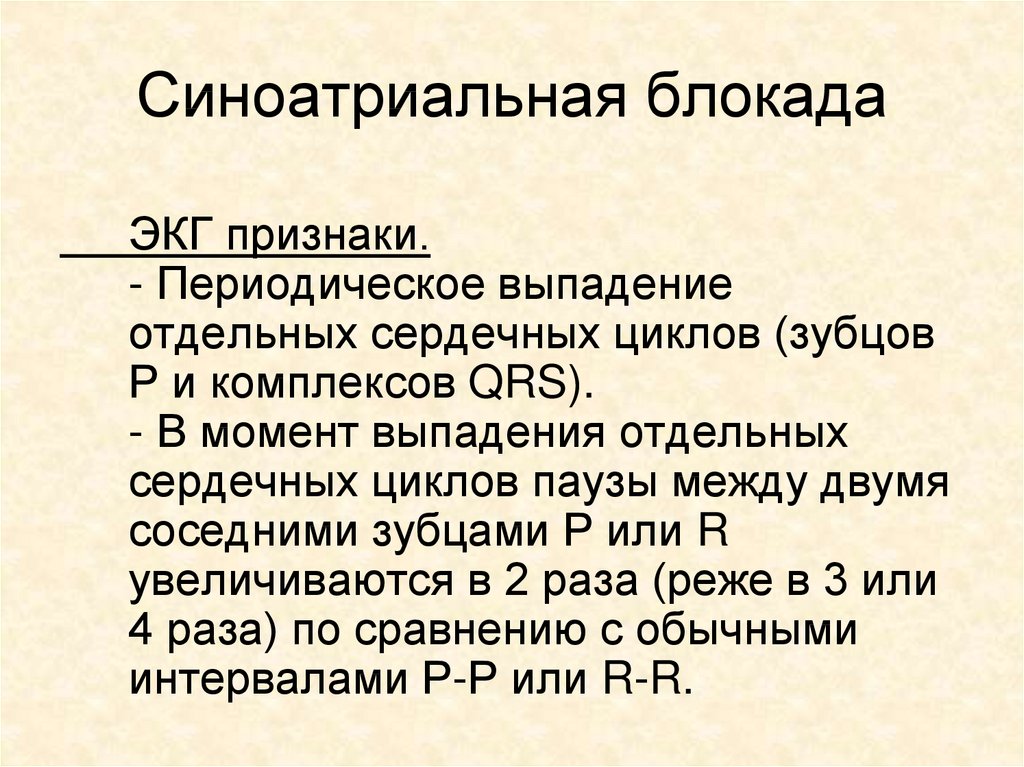 Синоатриальная блокада мкб