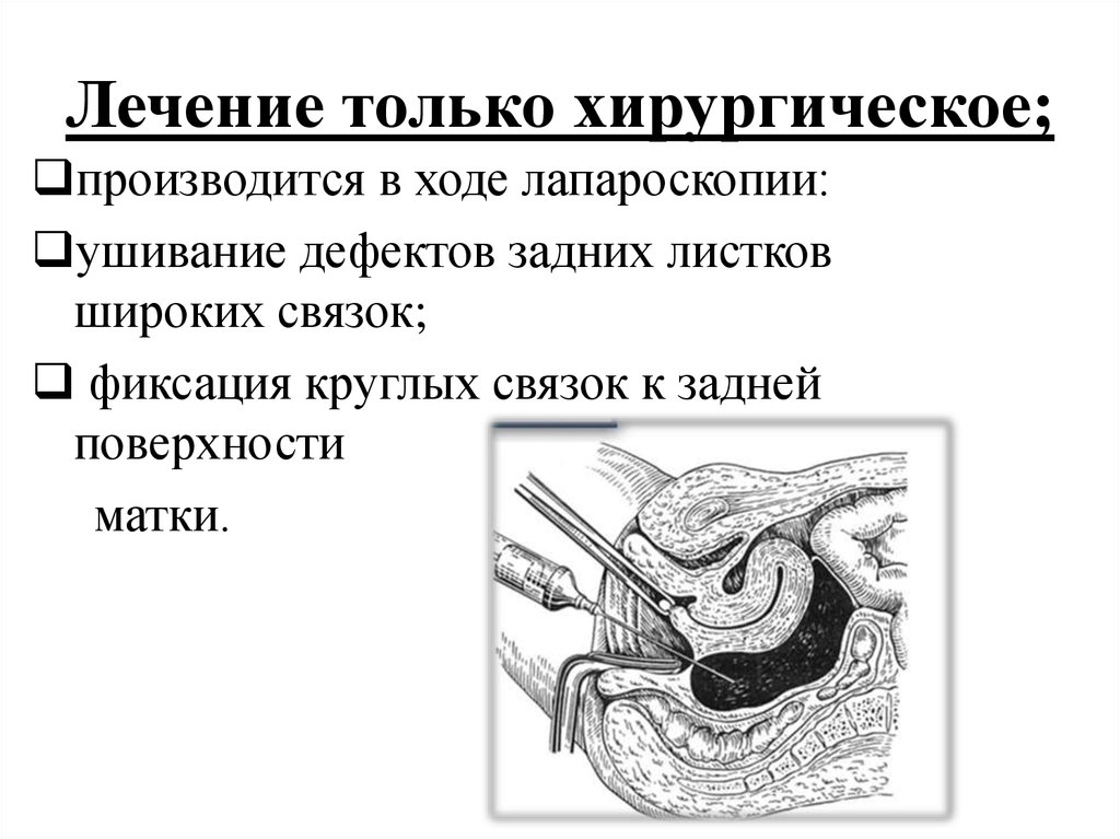 Лечение только хирургическое;