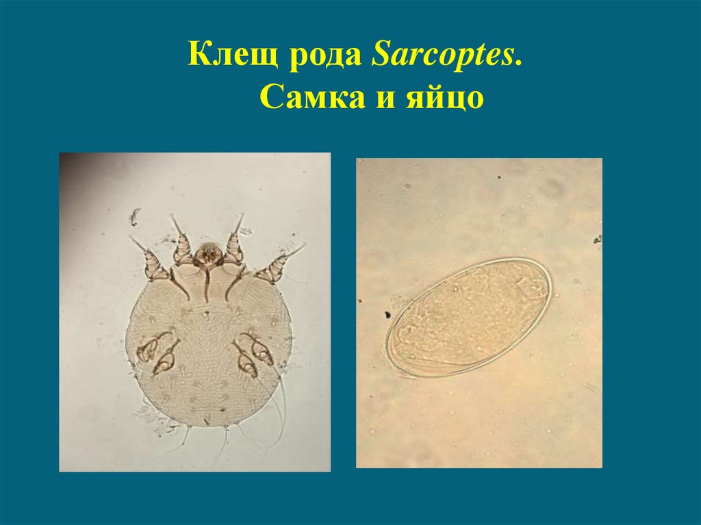 Цикл развития чесоточного клеща. Яйца чесоточного клеща под микроскопом. Чесоточный клещ Sarcoptes scabiei. Яйца чесоточного зудня. Клещи рода Sarcoptes.