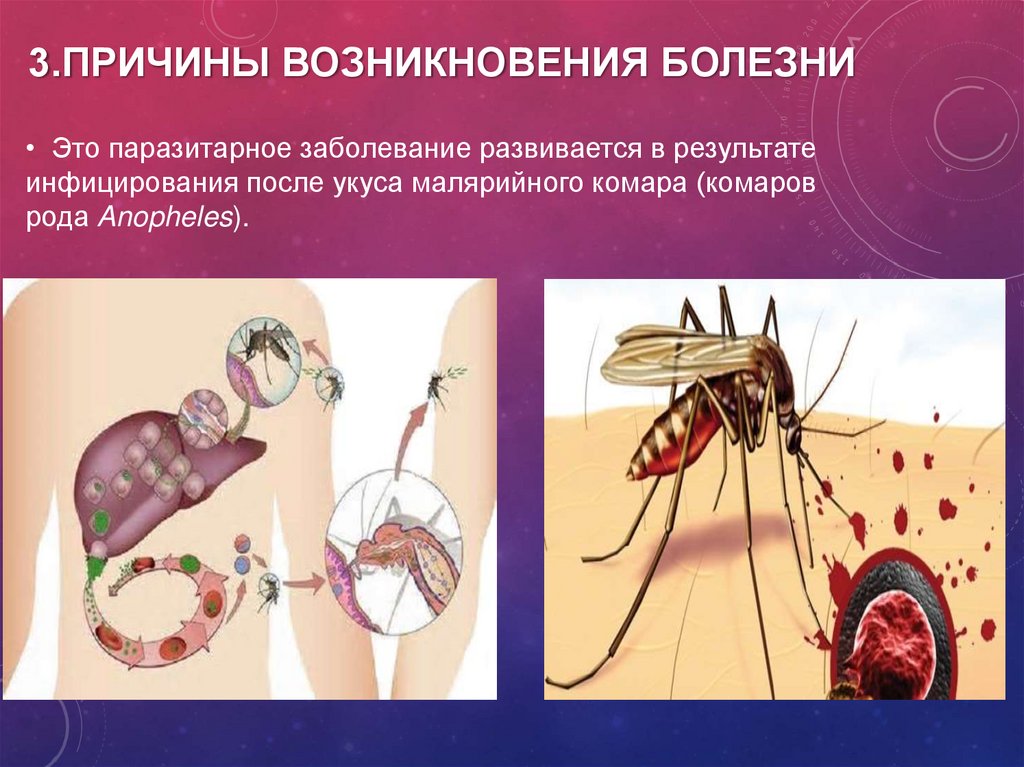 История малярии