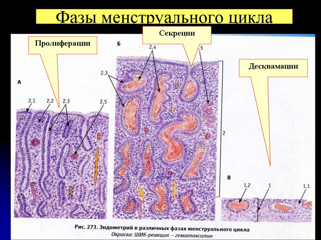 Эндометрия средней стадии фазы пролиферации. Стадия секреции эндометрия гистология. Пролиферация фаза менструационного цикла гистология. Десквамация это гистология. Стадия пролиферации гистология.