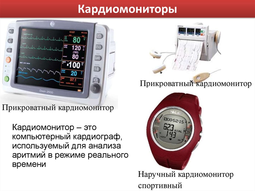 Кардиомонитор. Кардиомонитор наблюдение за пациентом. Кардиомониторы презентация. Кардиомонитор обозначения.