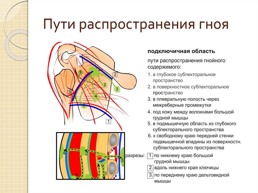 Лопаточная область анатомия. Пути распространения гноя из лопаточной области. Пути распространения гноя в подключичной области. Топографическая анатомия фасции верхней конечности. Топография сосудисто-нервных Пучков подключичной.