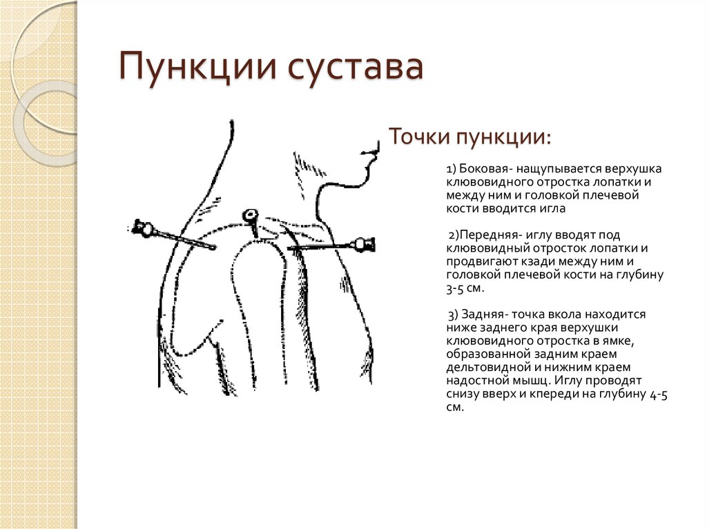 Суставы схема корнилова