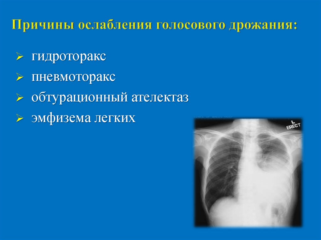 Операции на легких презентация