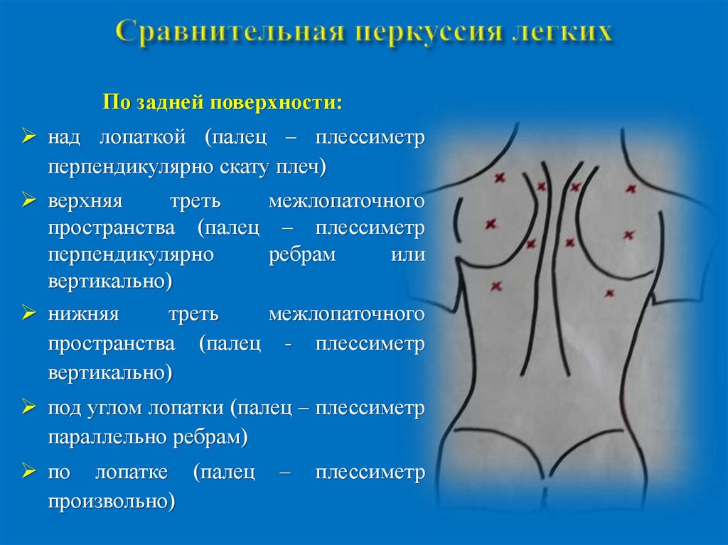 Сравнительная перкуссия. Сравнительная перкуссия грудной клетки сзади. Сравнительная перкуссия грудной клетки пропедевтика. Сравнительная перкуссия грудной клетки алгоритм. Сравнительная перкуссия легких алгоритм.