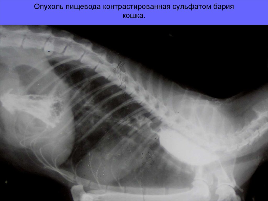 Пищевод кошки. Доброкачественная опухоль пищевода рентген.