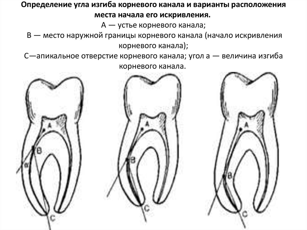 Трети корневого канала