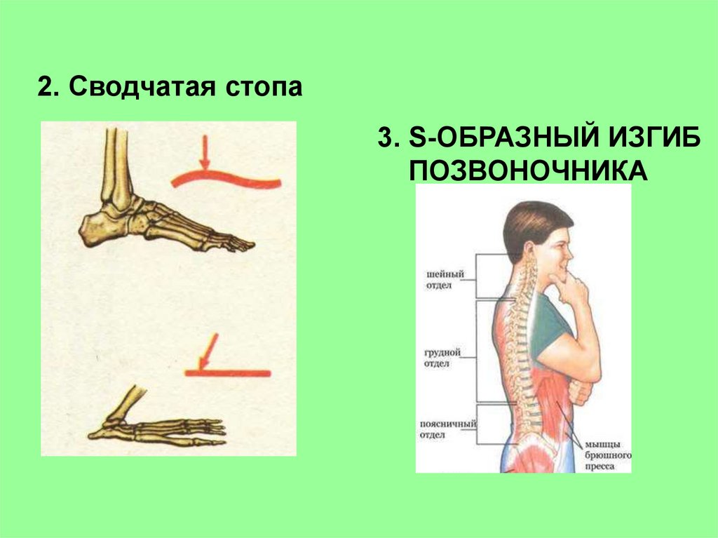 Скелет человека осанка