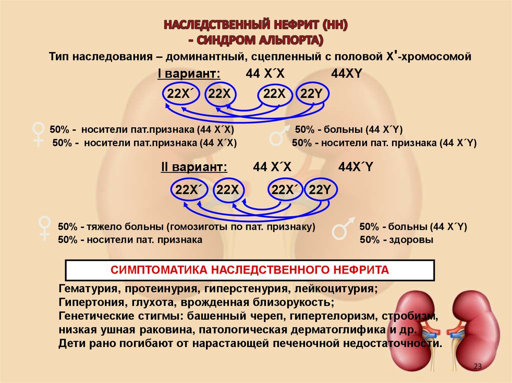 Синдром альпорта презентация