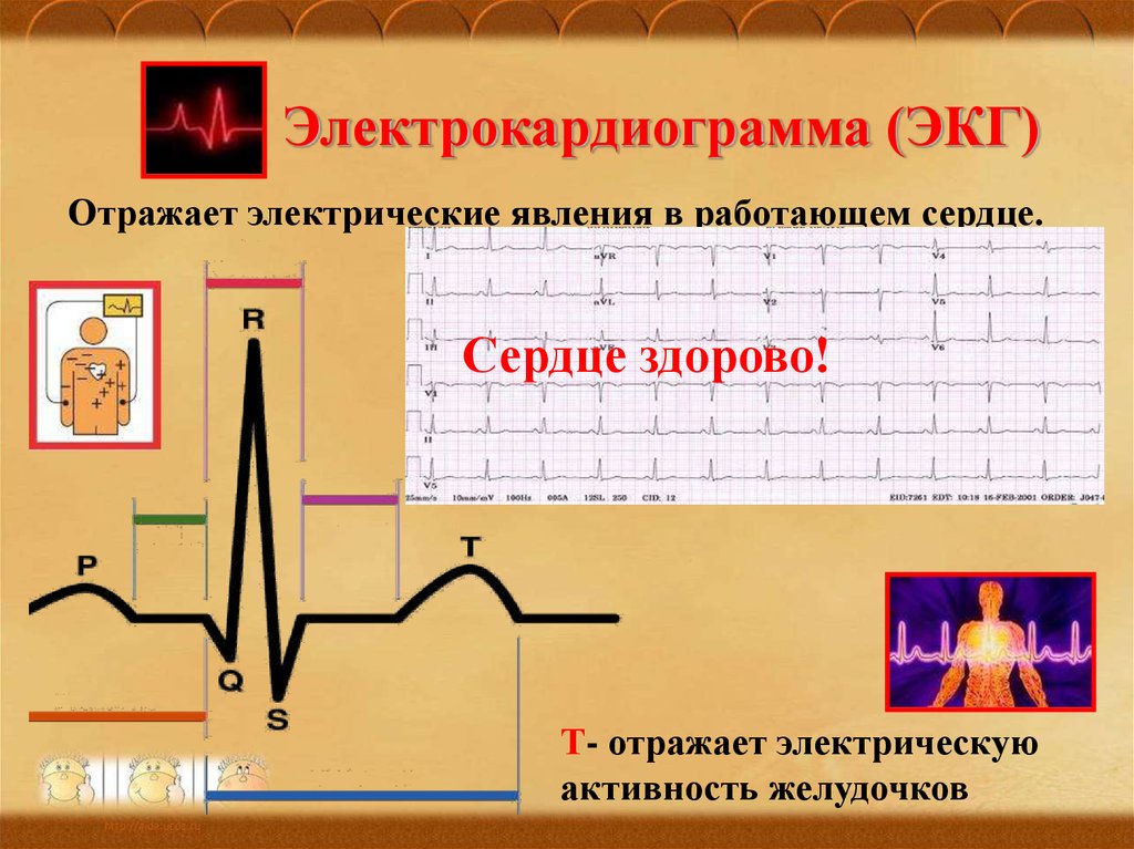 Увеличение электрической активности