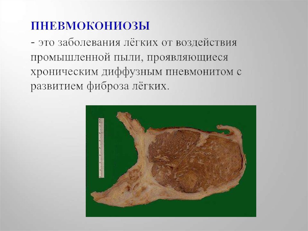 Компьютерная пыль влияние на организм