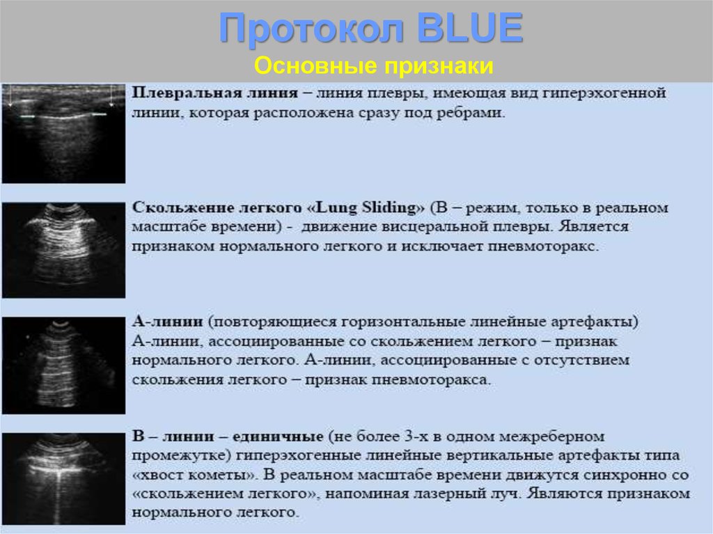 Протокол узи. УЗИ плевральных полостей протокол. УЗИ плевральной полости протокол УЗИ. Протокол УЗИ легких и плевры. УЗИ плевральной полости заключение протокол.