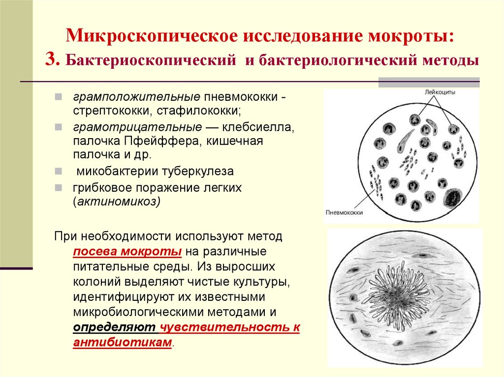 Микроскопическое исследование мокроты: 3. Бактериоскопический и бактериологический методы