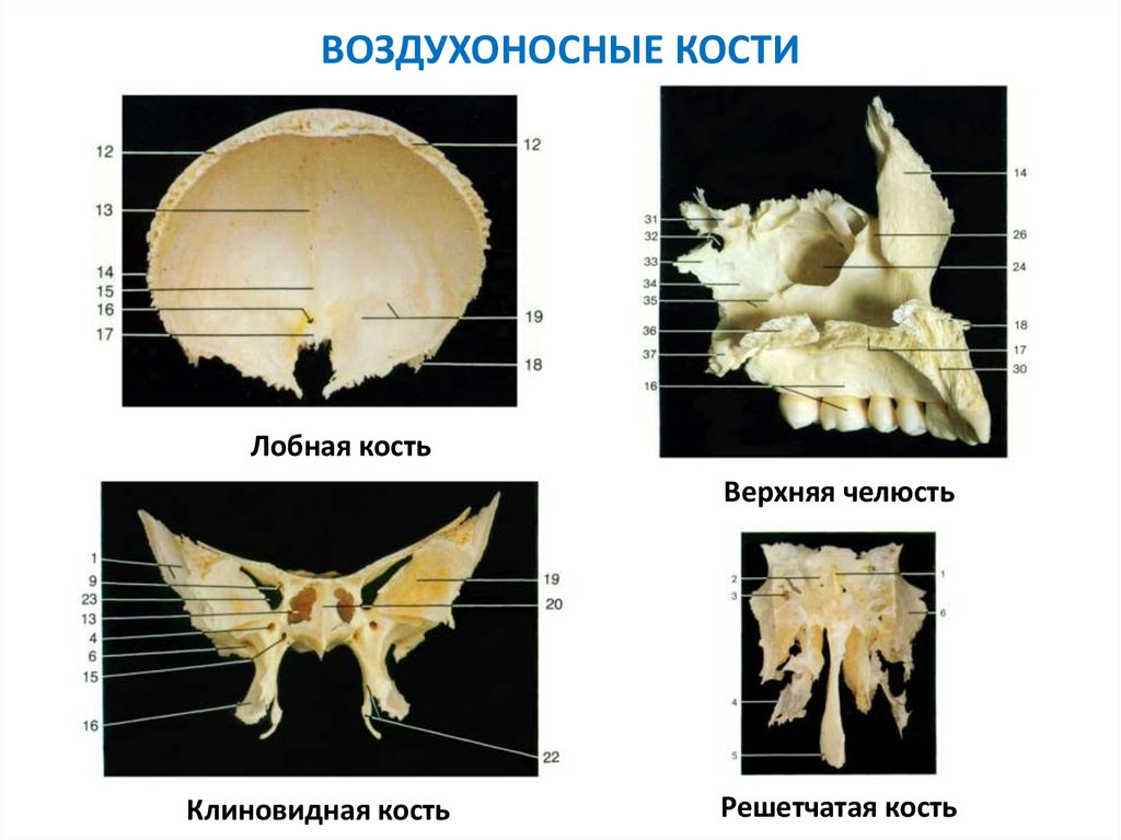 Кости имеющие воздухоносные пазухи. Пневматические воздухоносные кости черепа. Клиновидная кость черепа. Воздухоносные кости мозгового черепа. Клиновидная кость черепа анатомия воздухоносные кости.