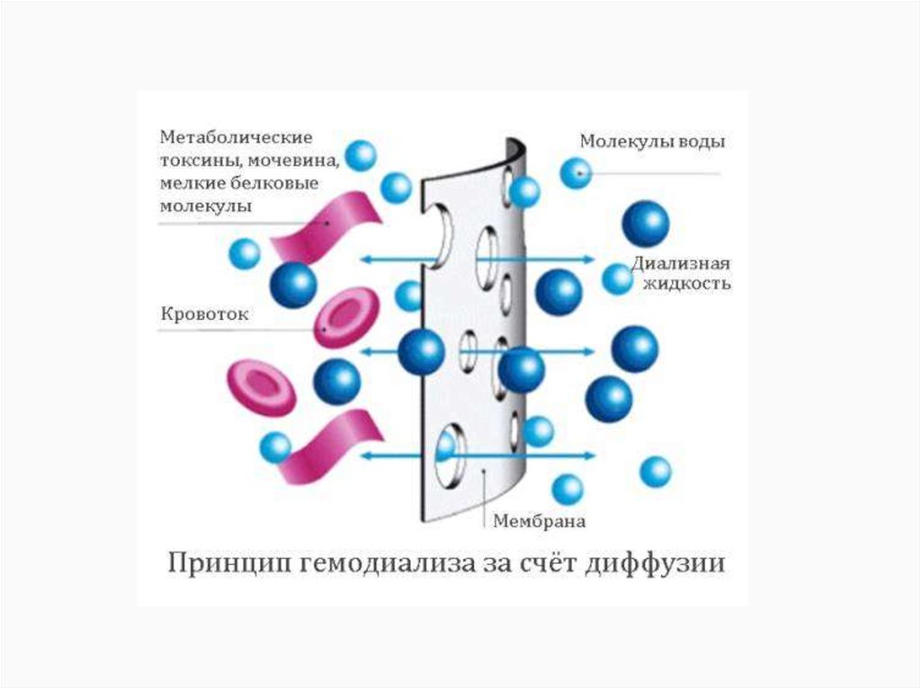 Заместительная почечная терапия презентация