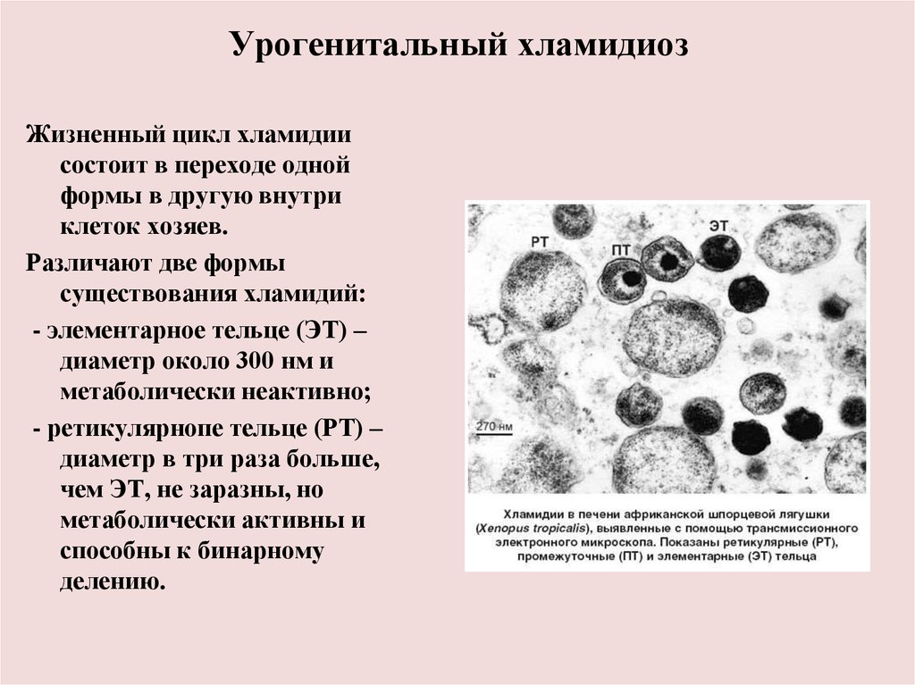 Хламидиоз 1. Хламидии препарат микробиология. Ретикулярное тельце хламидий. Хламидии - возбудители урогенитальных инфекций.