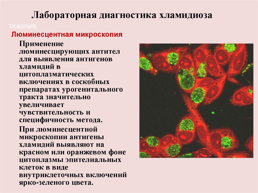 Трихомониаз диагностика