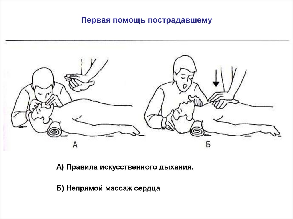 Искусственное дыхание и непрямой массаж. Искусственное дыхание и непрямой массаж сердца. Проведение искусственного дыхания и непрямого массажа. Искусственное дыхание и непрямой массаж сердца одним человеком. Непрямой массаж сердца и искусственное дыхание алгоритм.