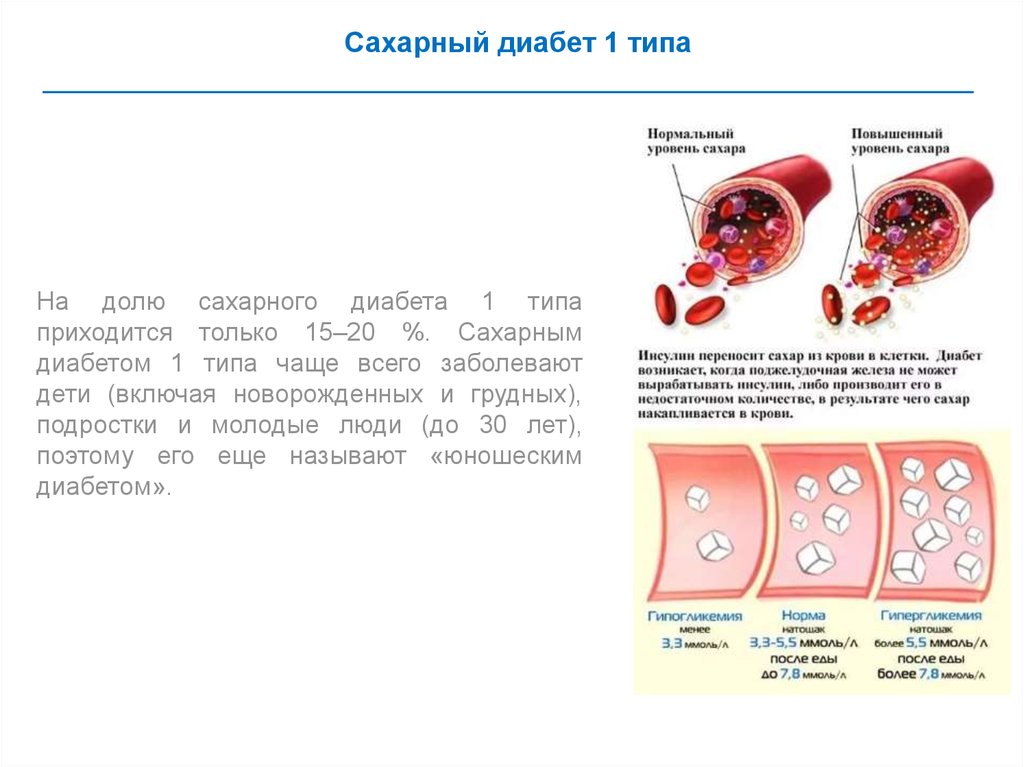 сахарный диабет лекция