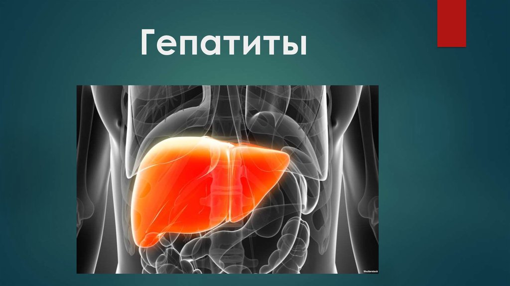 Презентация лекарственный гепатит