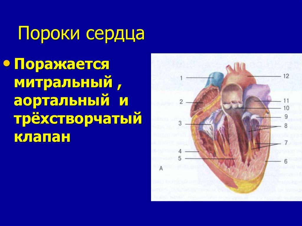 Порок сердца. Пороки левой и правой половины сердца.