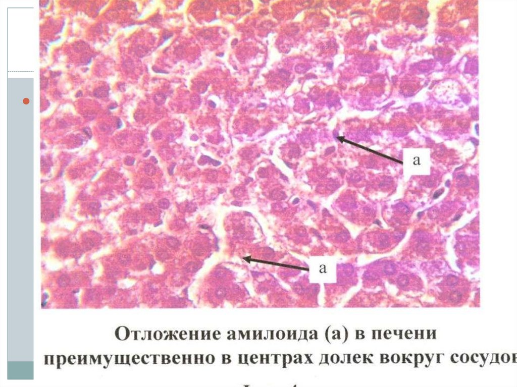 Саговая селезенка микропрепарат рисунок