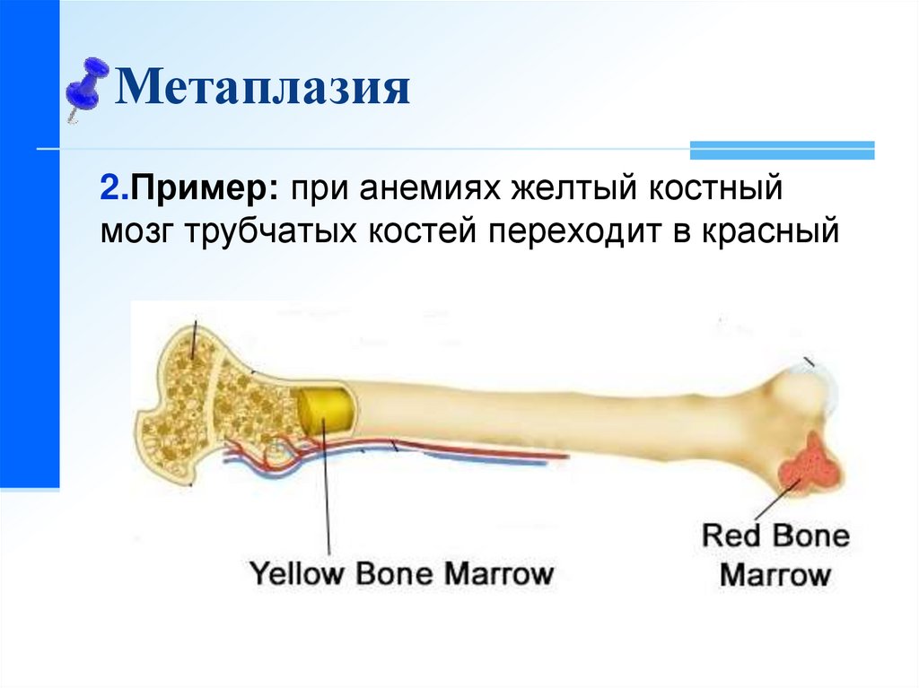 Что будет если есть костный мозг. Желтый костный мозг в кости. Красный костный мозг и желтый костный мозг. Трубчатые кости костный мозг. Жёлтый костный мозг в трубчатой кости.