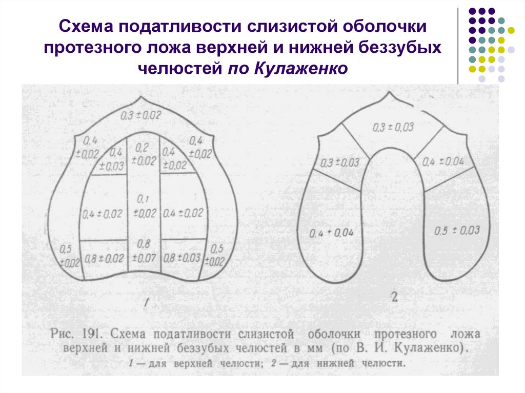 Люнд слизистой оболочки. Классификация податливости слизистой оболочки по Люнду. Зона податливости слизистой оболочки по Гаврилову. Классификация слизистой оболочки протезного ложа по Суппле. Зоны податливости слизистой оболочки верхней челюсти по Люнду.