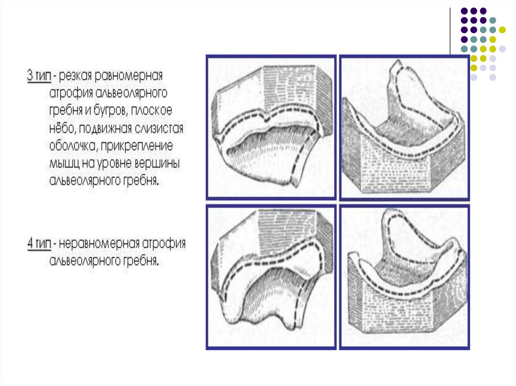 Классификация суппле картинки