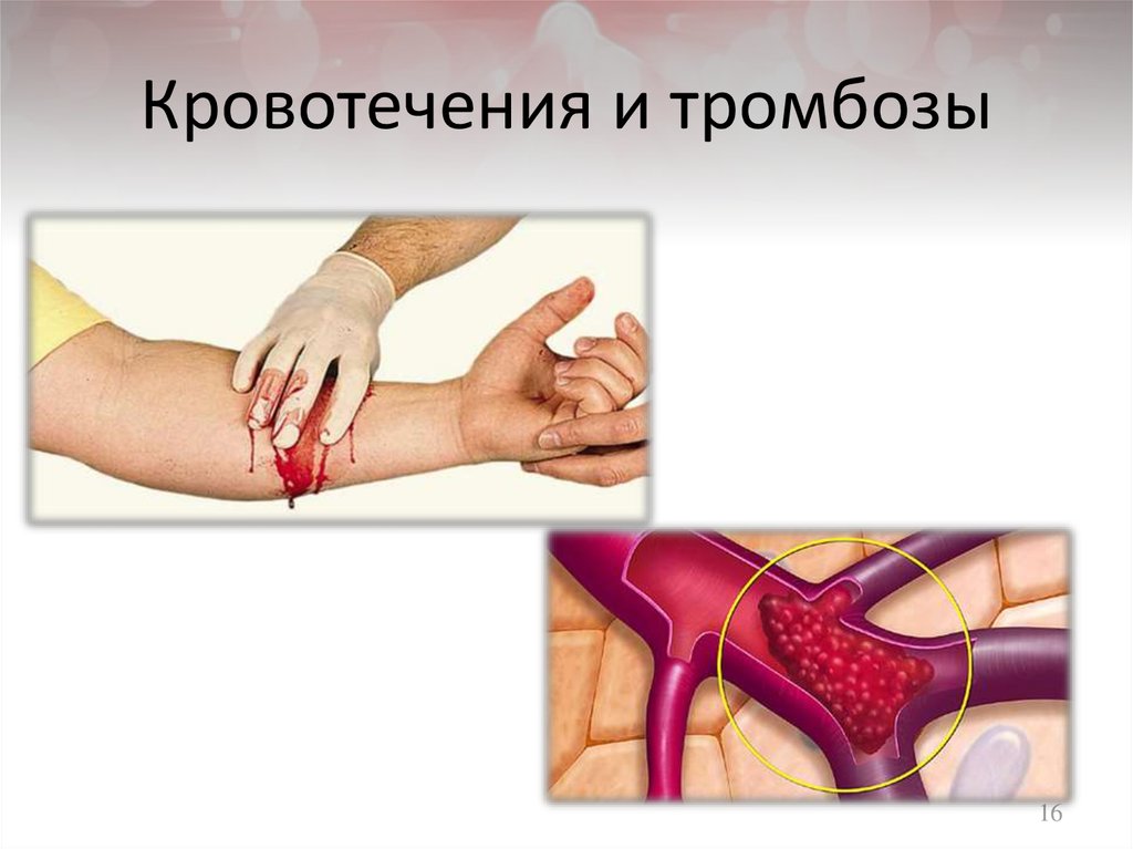 Кровотечения и тромбозы