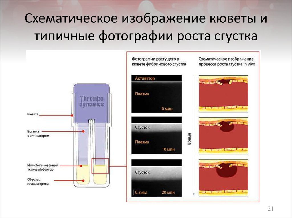 Схематическое изображение кюветы и типичные фотографии роста сгустка