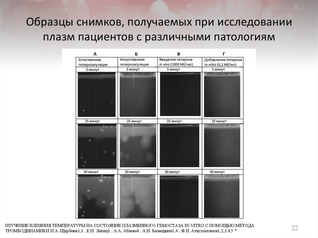 Образцы снимков, получаемых при исследовании плазм пациентов с различными патологиям