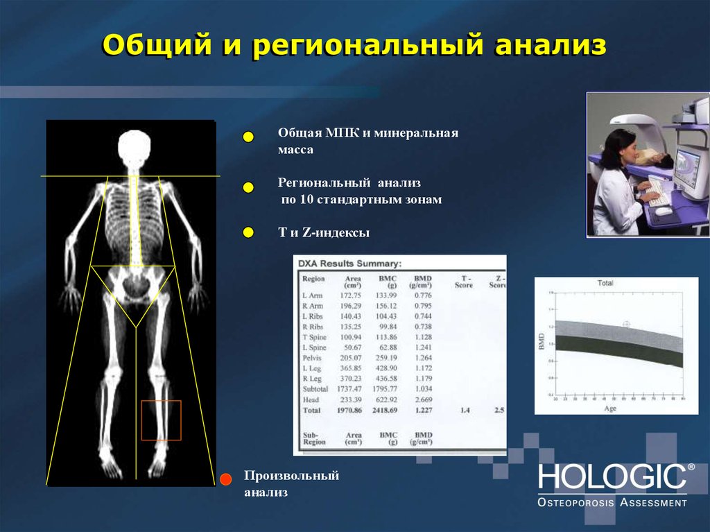 Тело суммарный. Остеометрия костей. Денситометрия презентация. МПК денситометрия что такое. Денситометрия костей туловища.