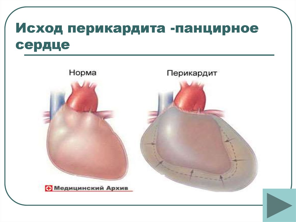 Помним сердцем презентация